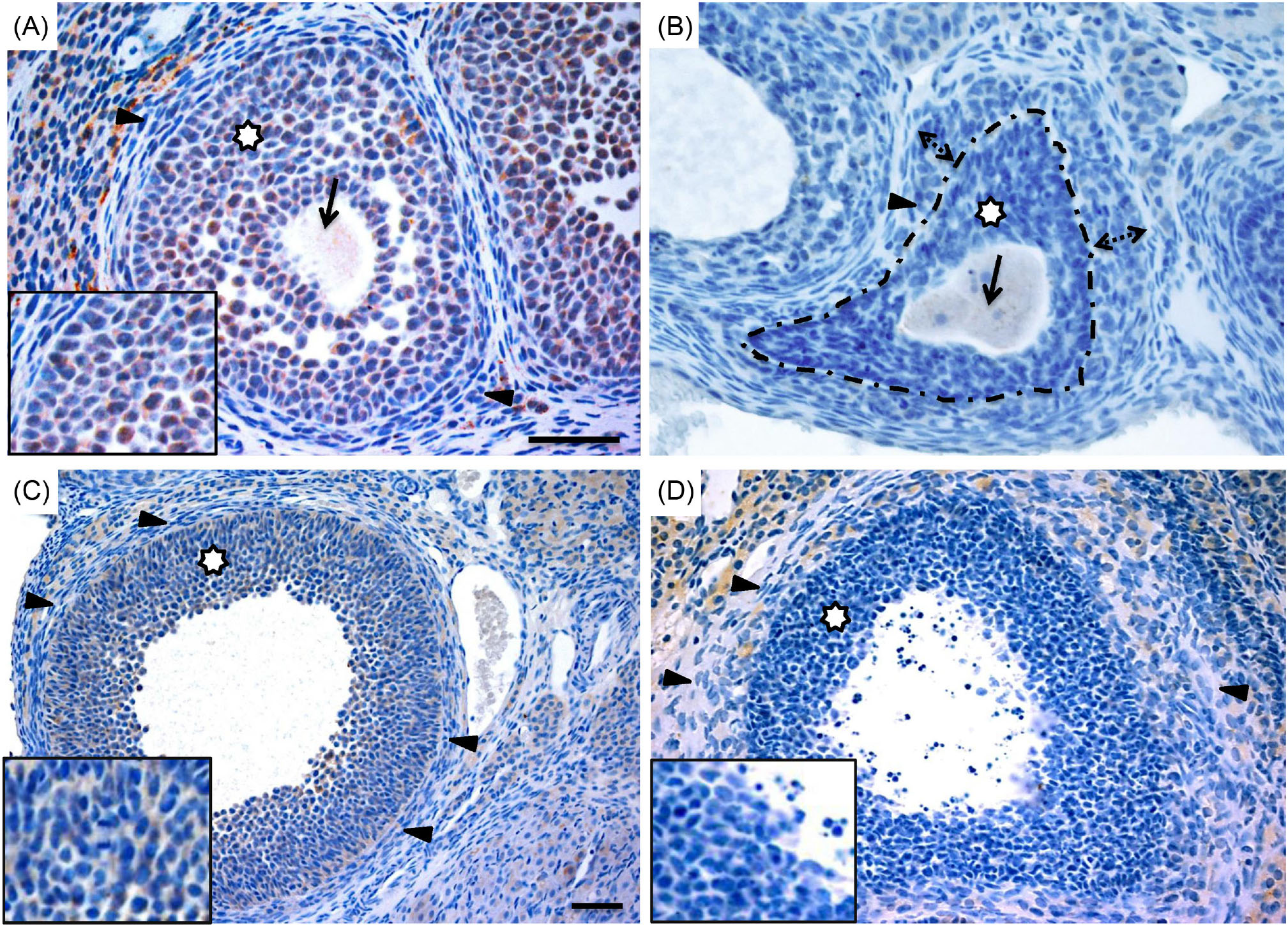 Preantral Follicular Atresia Occurs Mainly Through Autophagy While Antral Follicles Degenerate