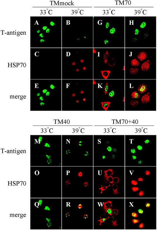 Overexpression Of Heat Shock Protein 70 Restores The Structural Stability And Functional Defects Of Temperature Sensitive Mutant Of Large T Antigen At Nonpermissive Temperature