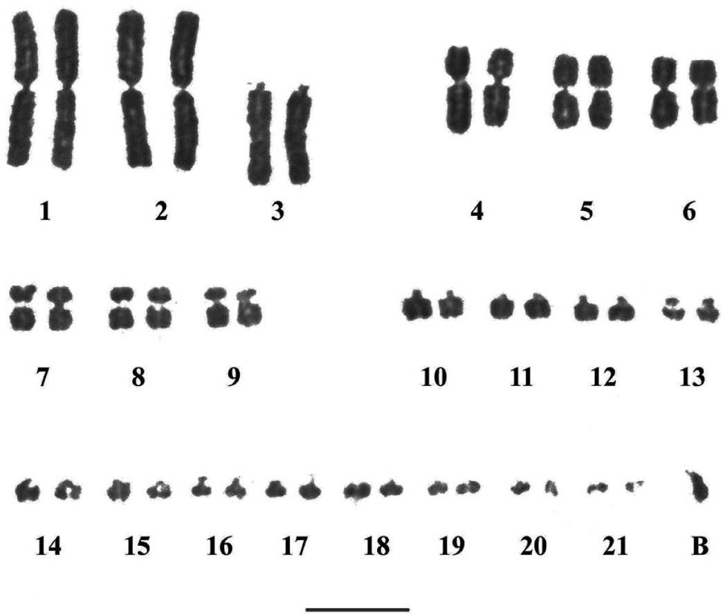 First Report Of B Chromosomes In Caecilians (Amphibia: Gymnophiona)