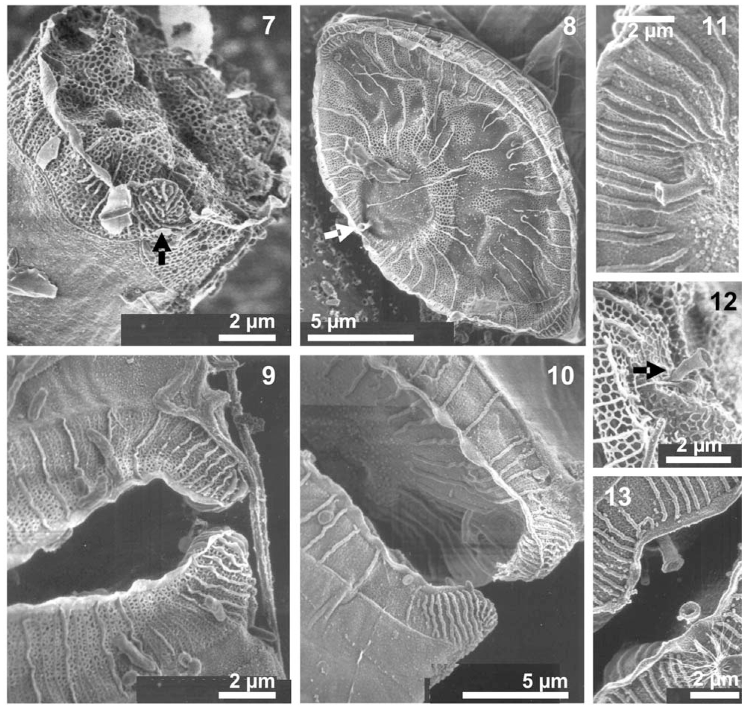 Helicotheca Ribbons Morphological Study of Two Closely Related Marine Planktonic Diatoms ...