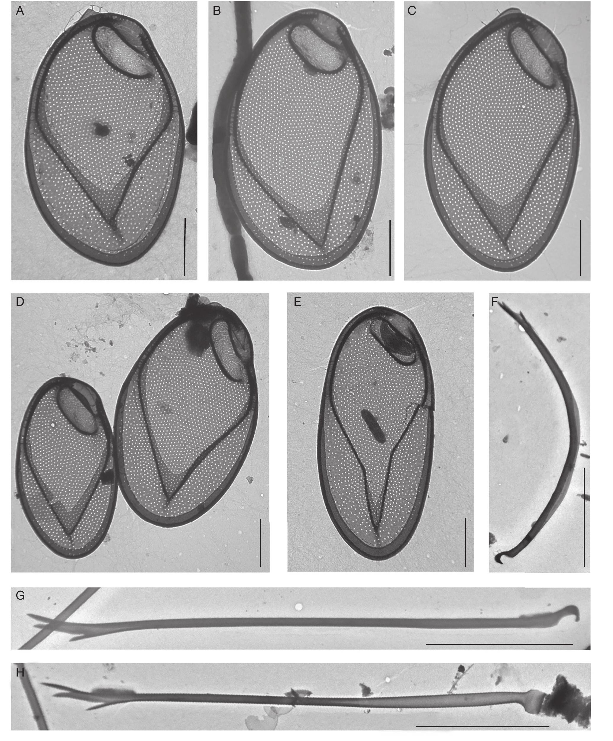 Mallomonas Vietnamica Gusev Kezlya Tran Sp Nov Synurales Chrysophyceae A New Species That Shares Some Features With Fossil Taxa