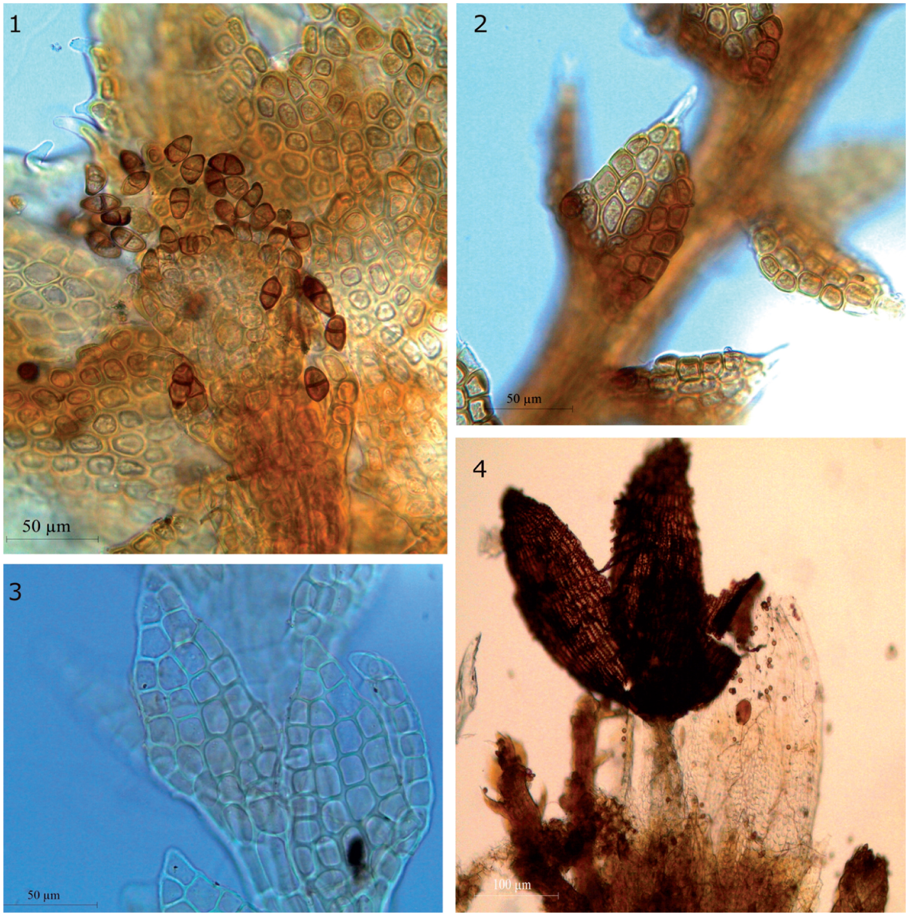 https://bioone.org/journals/Cryptogamie-Bryologie/volume-38/issue-1/v38.iss1.2017.53/Disjunct-or-Continuous-On-the-Distributional-Pattern-of-Cephaloziella-hampeana/10.7872/cryb/v38.iss1.2017.53.full