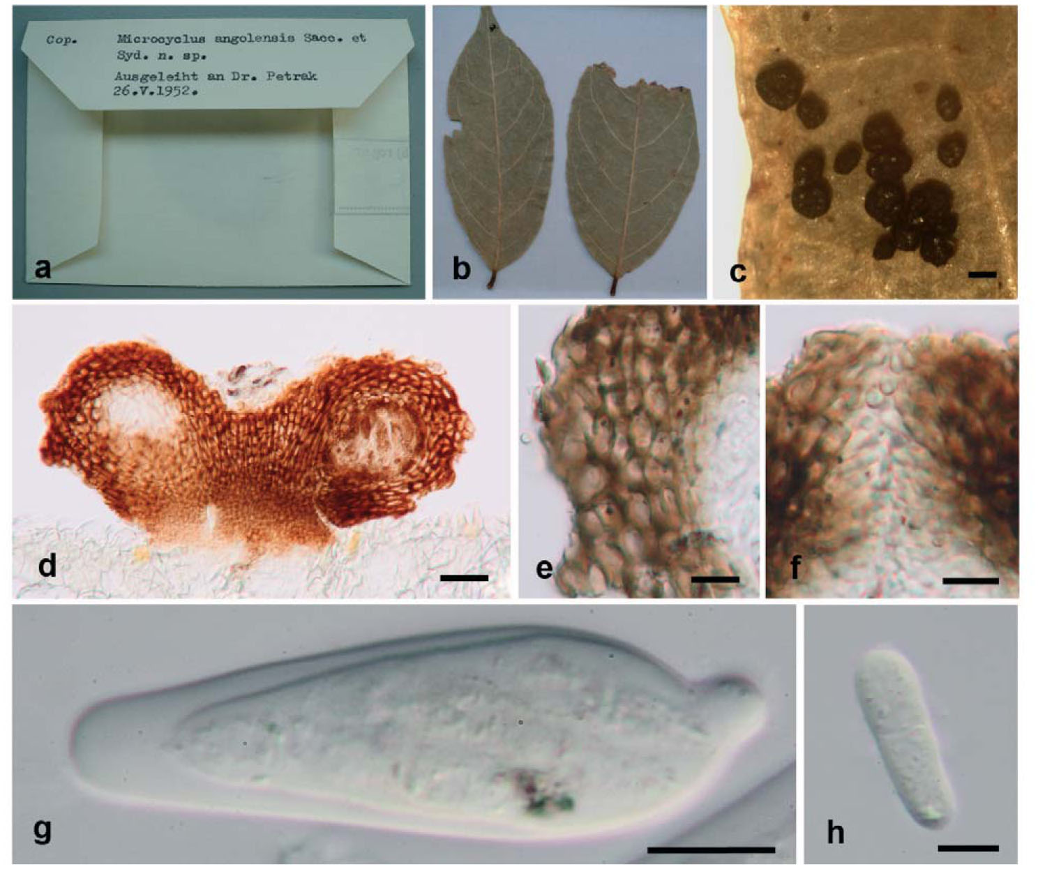 Planistromellaceae Botryosphaeriales