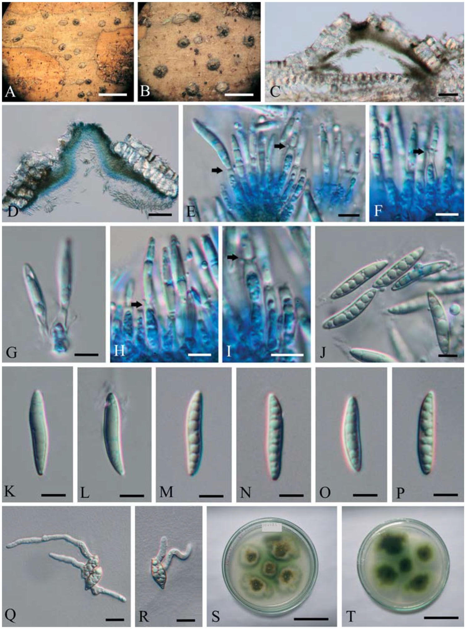 Pustulomyces gen. nov. Accommodated in Diaporthaceae, Diaporthales, as ...