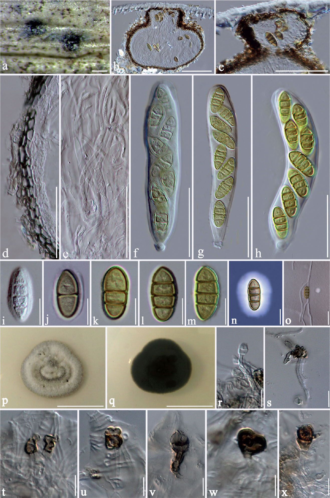 Additions to Sporormiaceae: Introducing Two Novel Genera, Sparticola ...