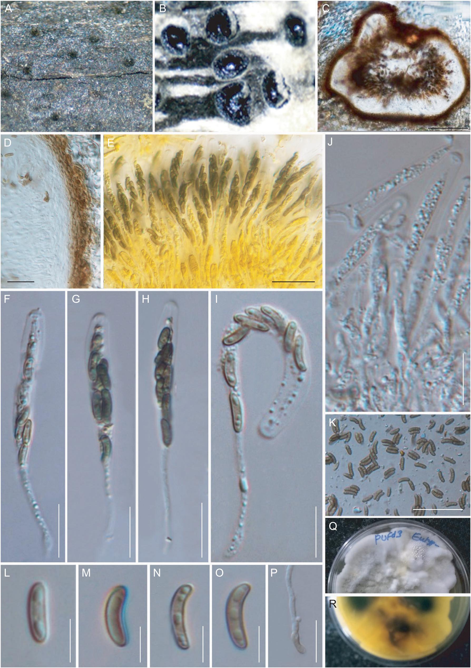 Modern Taxonomic Approaches To Identifying Diatrypaceous Fungi From Marine Habitats With A Novel Genus Halocryptovalsa Dayarathne K D Hyde Gen Nov
