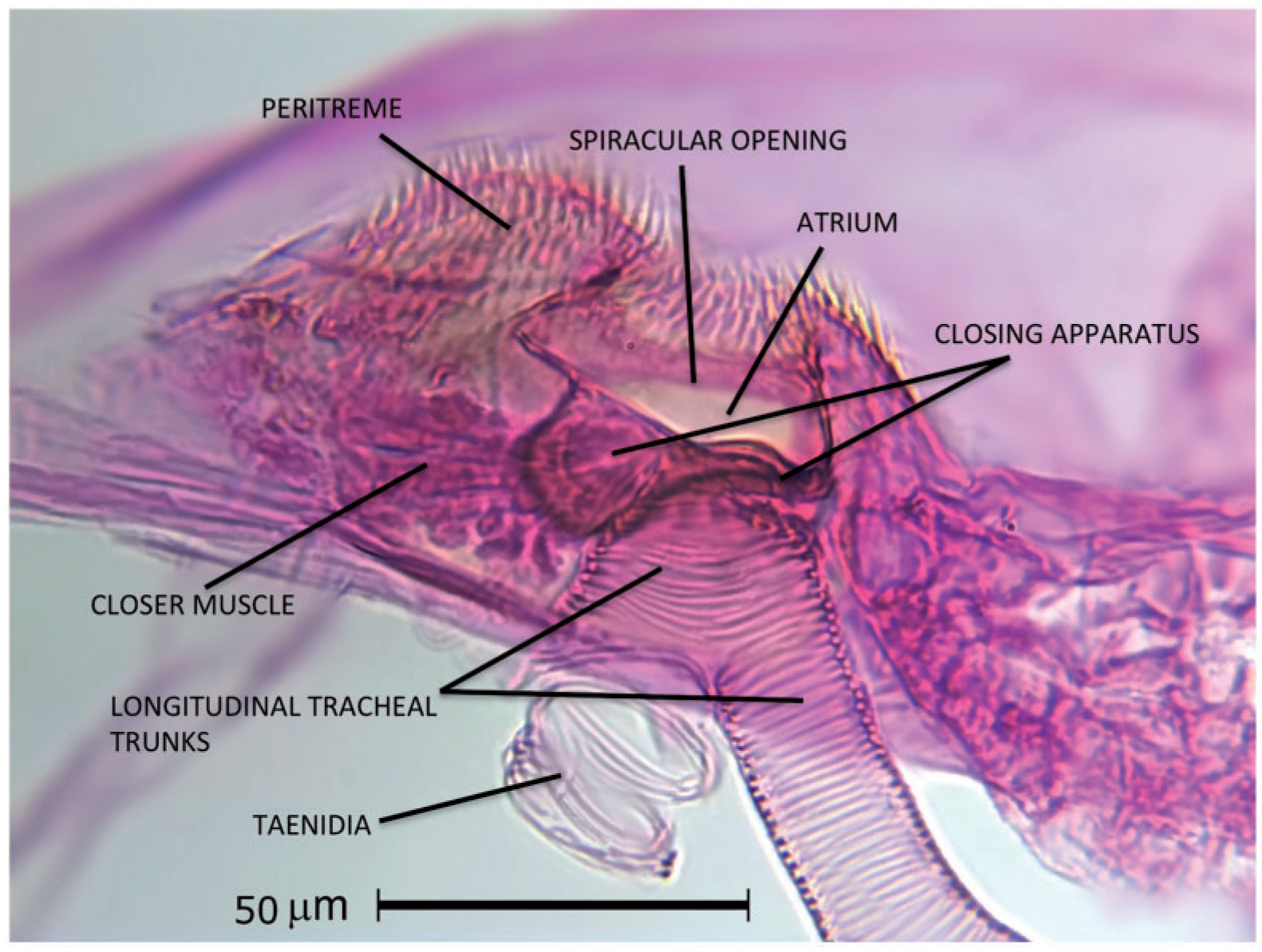 Visualizing the Mesothoracic Spiracles in a Bark Beetle: Hypothenemus ...