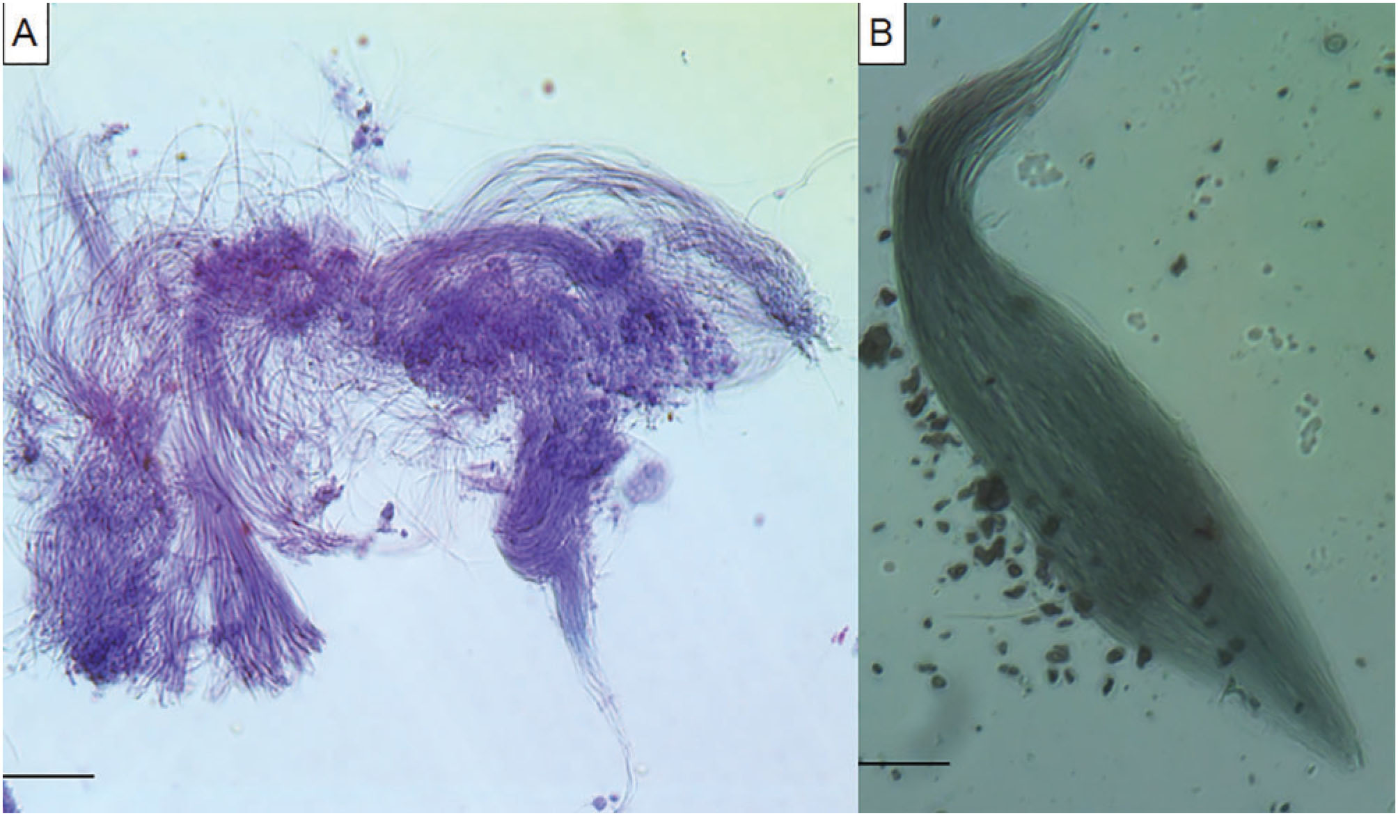 Description of the Sperm and Spermatheca of Hypothenemus hampei ...