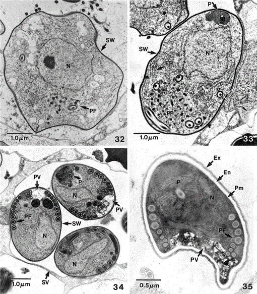 Life Cycle, Ultrastructure and Molecular Phylogeny of Hyalinocysta ...