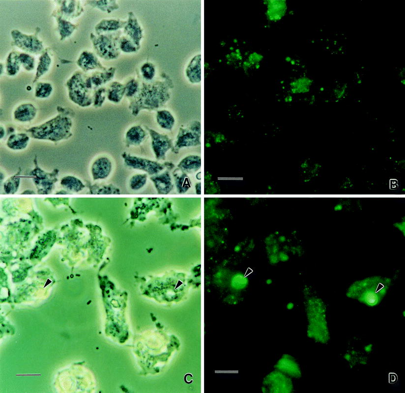 Trichomonas Vaginalis In Vitro Attachment And Internalization Of Hiv 1 And Hiv 1infected 9714