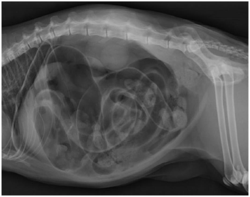 Chronic intestinal pseudo-obstruction associated with enteric ...