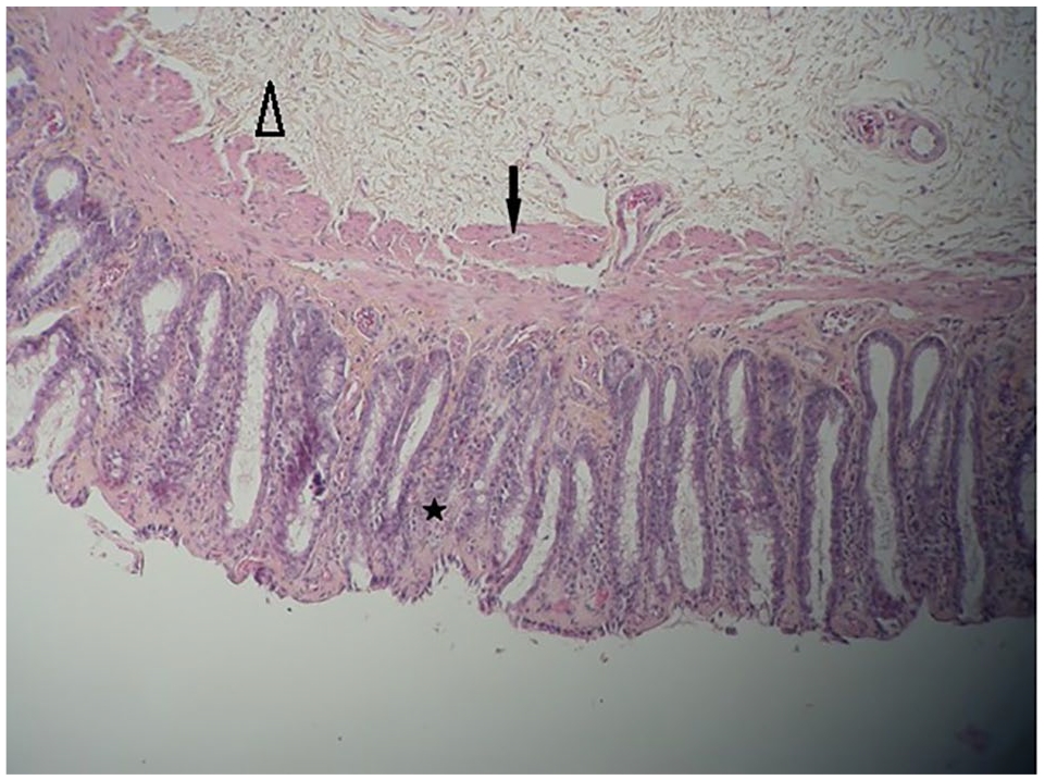 Rectal duplication in an adult cat: a novel transanal surgical approach