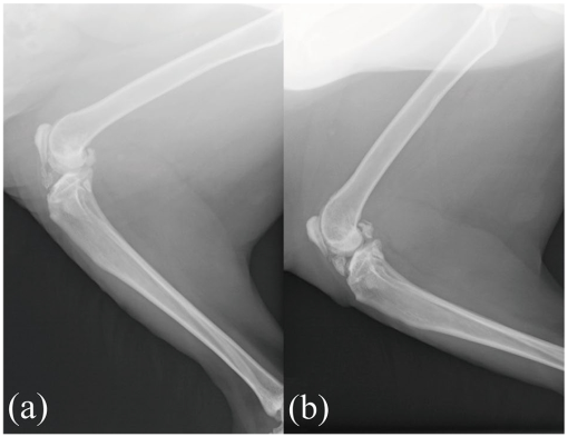 Successful treatment and long-term follow up of idiopathic immune ...