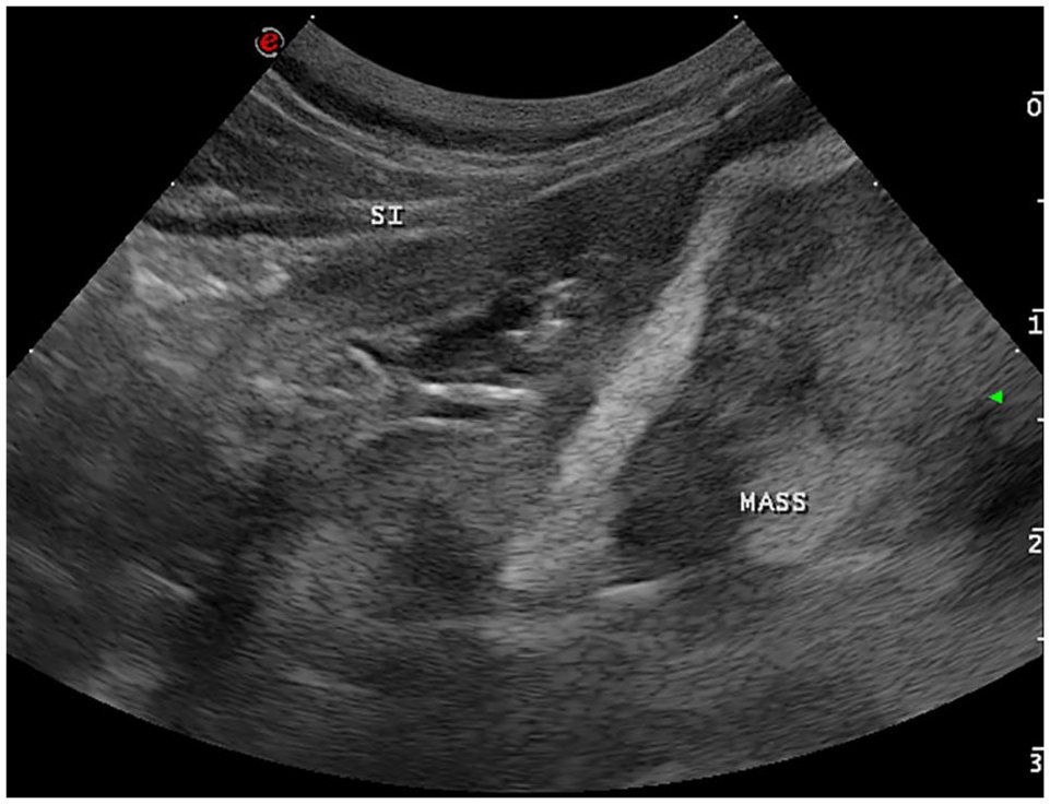 A case of an intramural, cavitated feline gastrointestinal eosinophilic ...