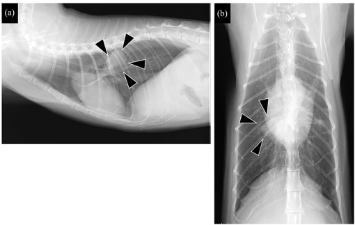 lung abscess x ray