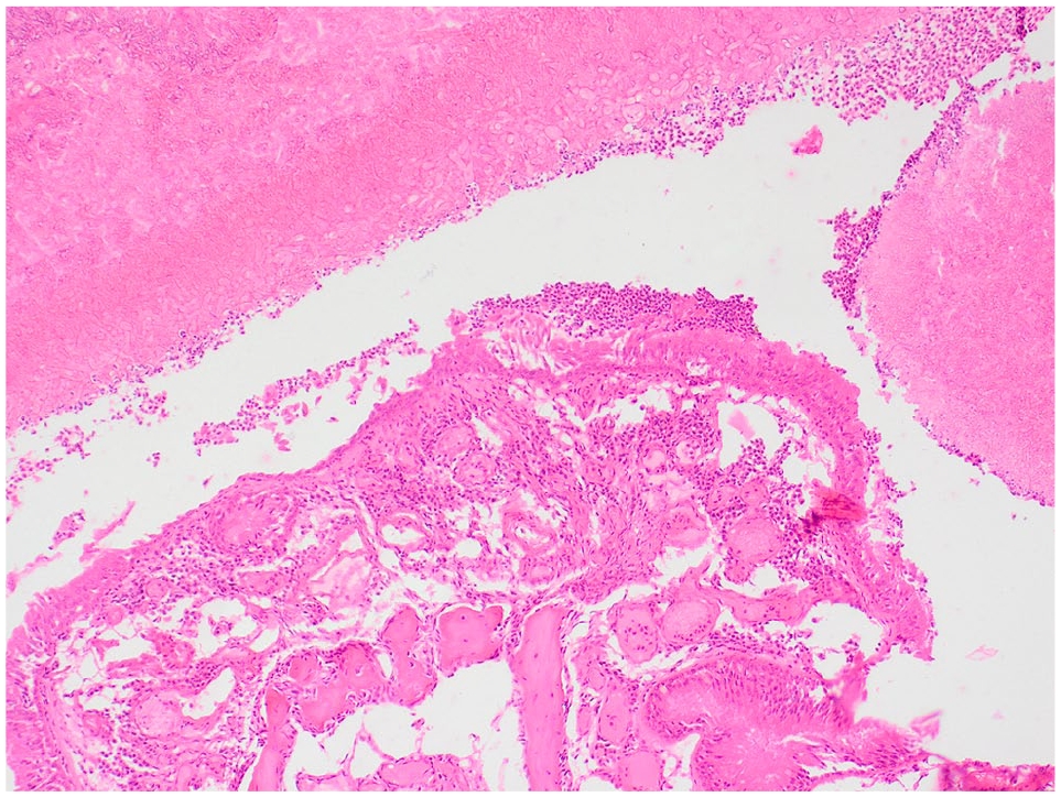 Clinical remission of feline sino-nasal aspergillosis despite evidence ...