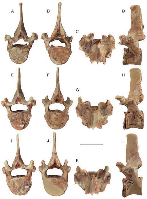 Common underlays included anterior base wedges and sacral cutouts