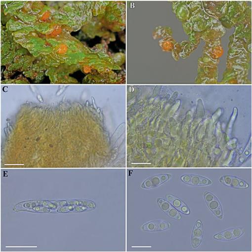 Octosporella microtricha and O. nematospora – Two New Pezizalean ...