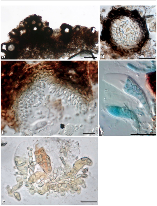 A new species of Stigmidium (Mycosphaerellaceae) on Bulbothrix ...