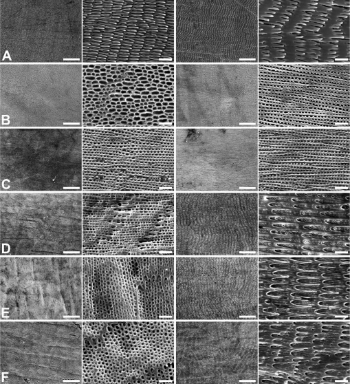 Wear Resistance Improvement of Keeled Structure and Overlapped Distribution  of Snake Scales