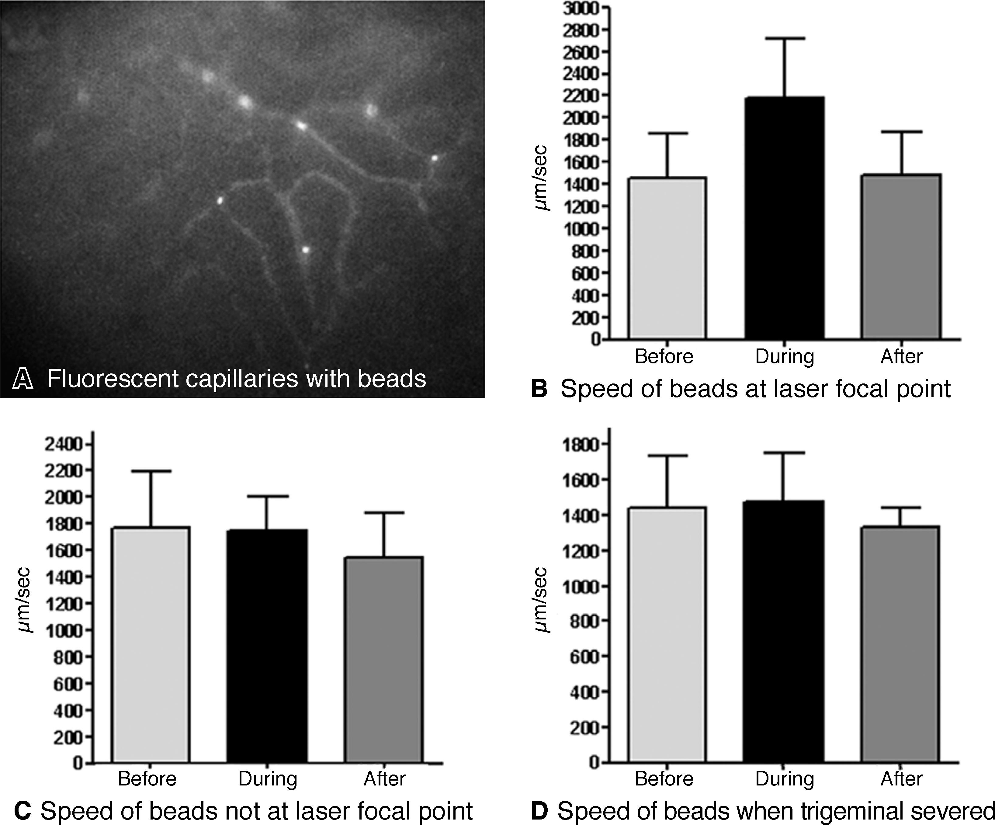 Infrared Organs Of Snakes: An Integral Part Of Vision