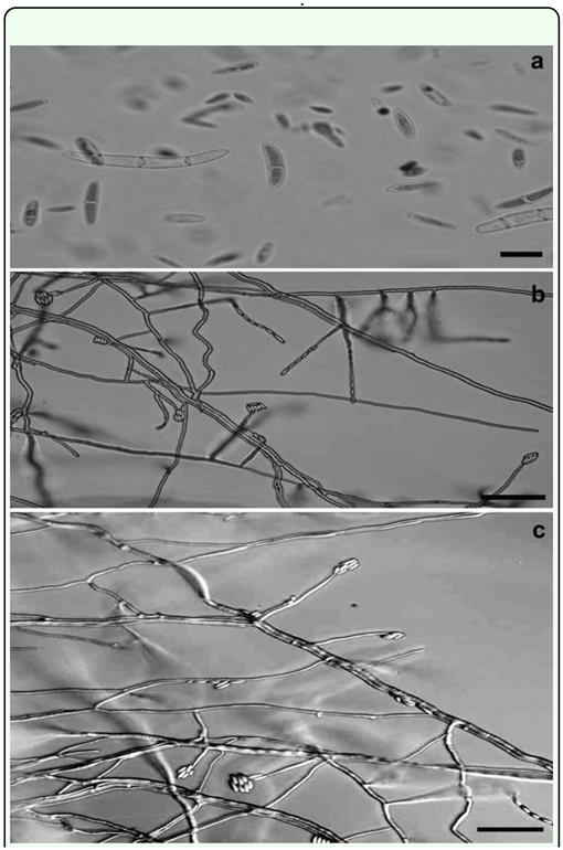 microconidia of fusarium