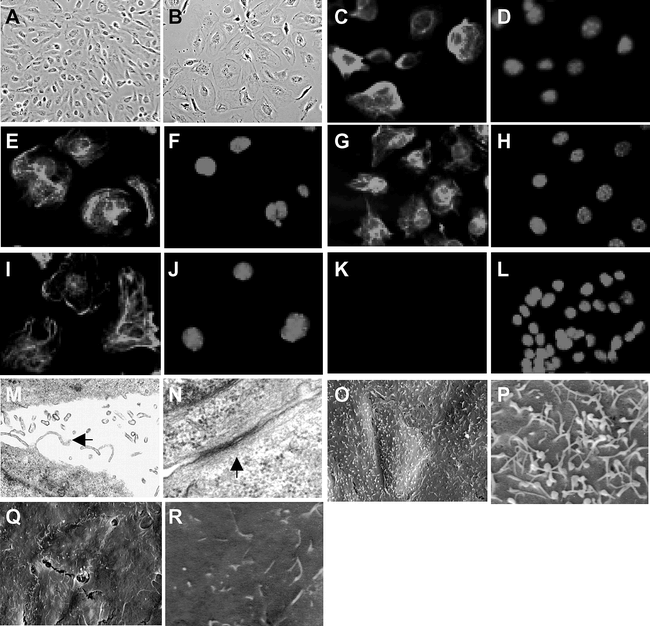 Conditionally Immortal Ovarian Cell Lines For Investigating The Influence Of Ovarian Stroma On The Estrogen Sensitivity And Tumorigenicity Of Ovarian Surface Epithelial Cells