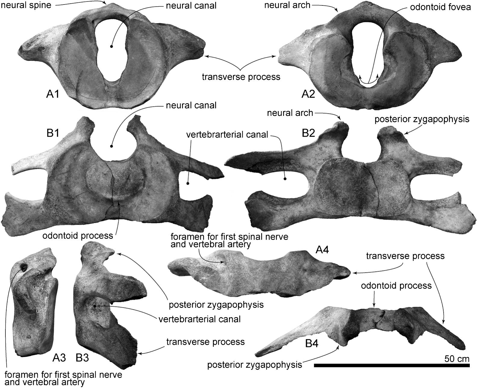 A Fin Whale from the Holocene (Quaternary) of Osaka City, Japan