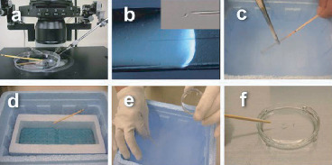 Single Spermatozoon Freezing Using Cryotop