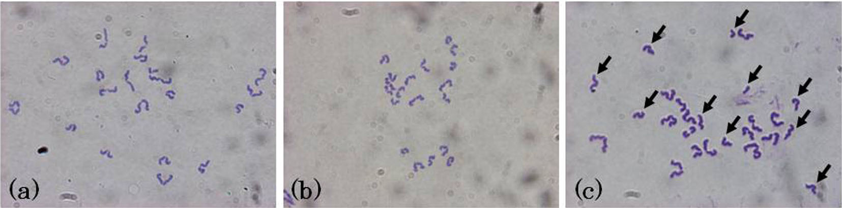 Risk of Premature Chromatid Separation is Increased by Poor Cumulus ...