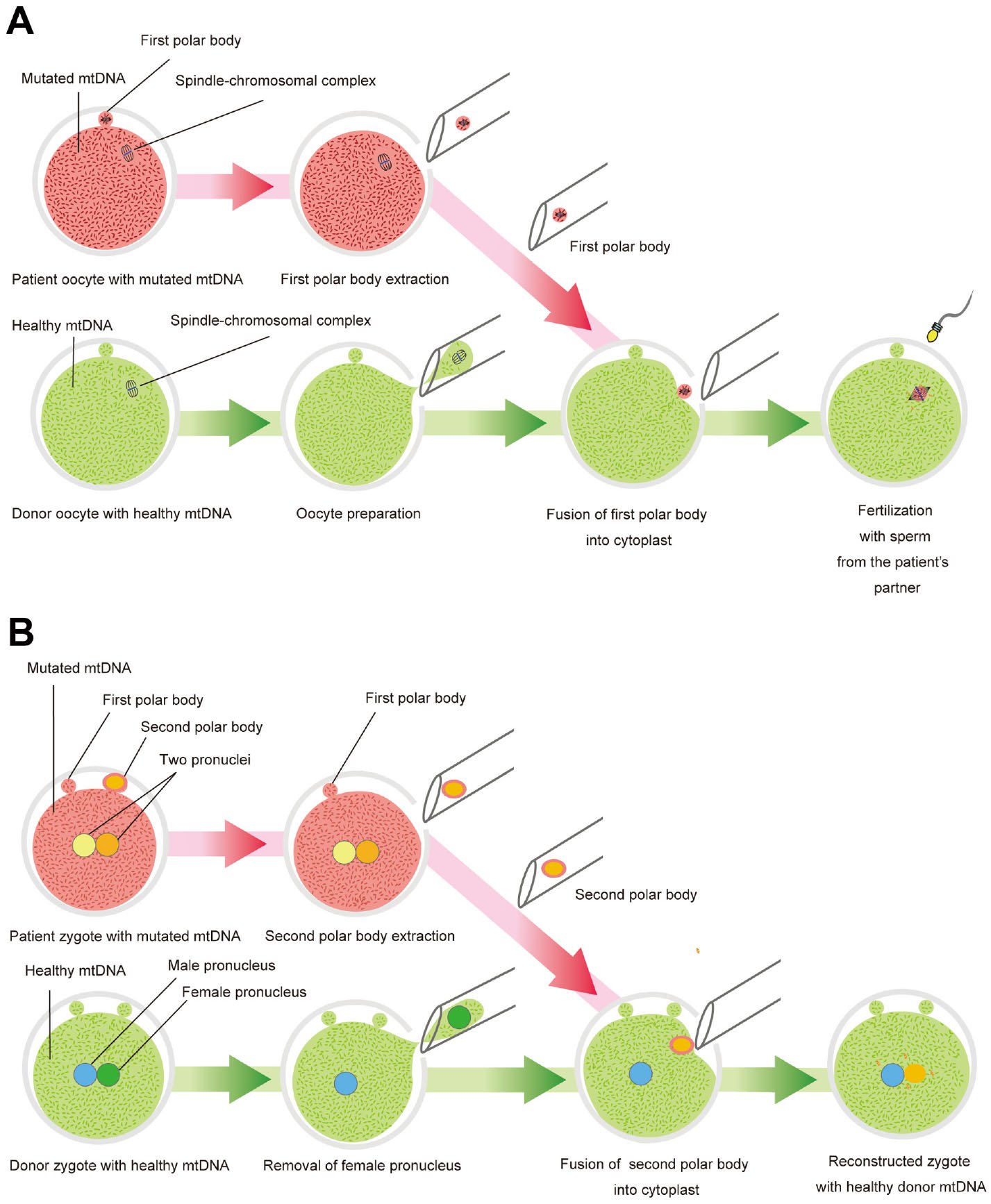 Challenges Towards Establishing Germline Gene Therapy For Inherited 