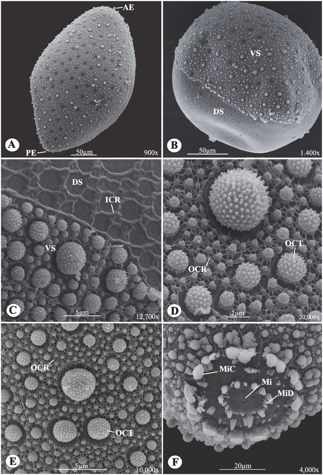 Scanning Electron Microscopy Of The Eggs Of Coquillettidia Shannoni Lane Antunes 1937 And Phoniomyia Quasilongirostris Theobald 1907 Diptera Culicidae