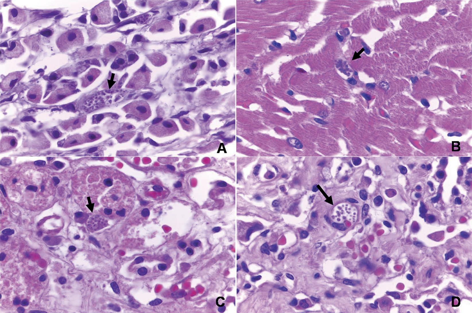 Natural Infection of Wild Canids (Cerdocyon thous and Lycalopex ...