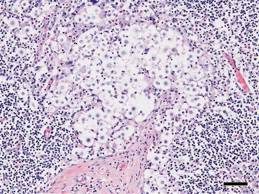 Cryptococcus gattii Type VGIIa Infection in Harbor Seals (Phoca ...