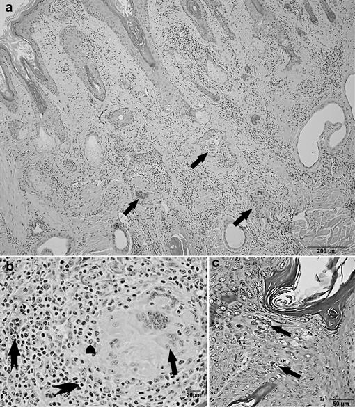 Sheep-associated Malignant Catarrhal Fever–like Skin Disease In A Free 