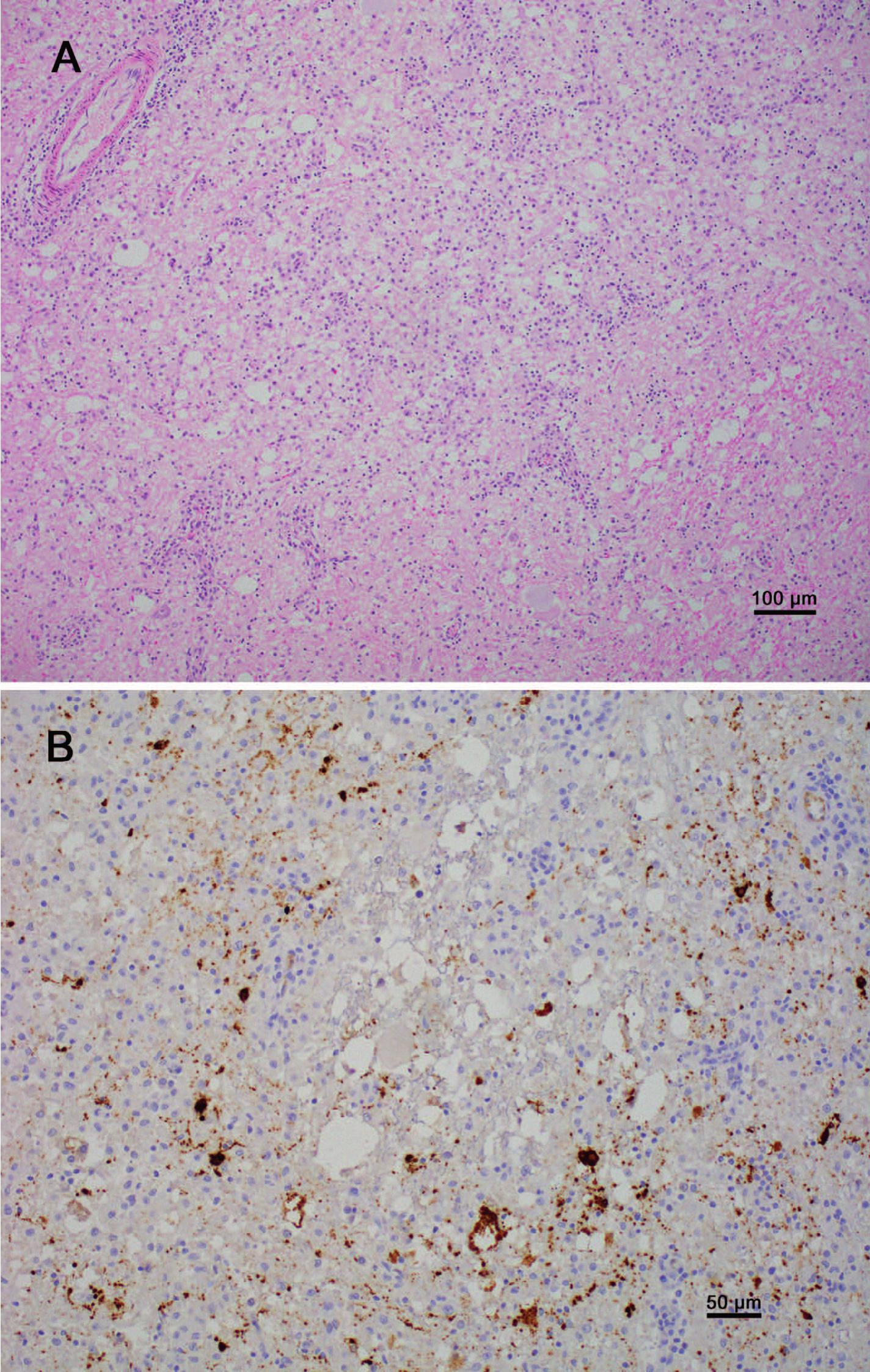 detection-and-preliminary-characterization-of-phocine-distemper-virus