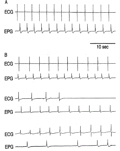 i0289-0003-13-1-55-f02.gif