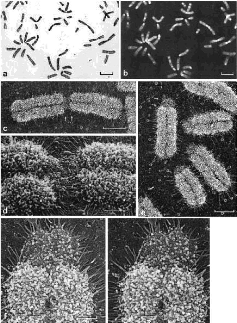 electron microscope images of chromosomes