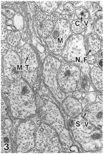 A high magnification image of synapse obtained by electron microscopy