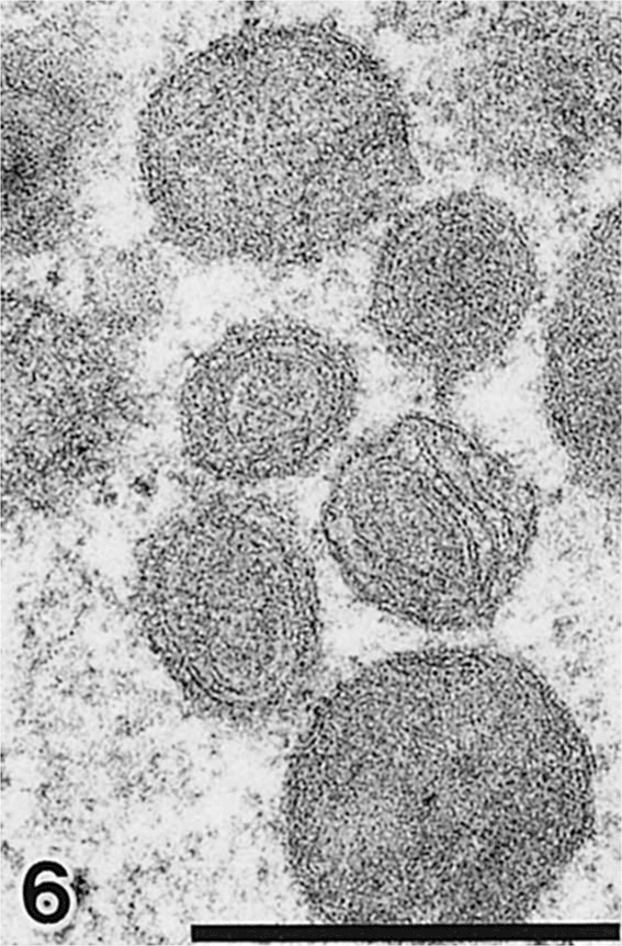 Multilaminar  Vesicular Bodies Accumulating Glycoconjugates In Primary 