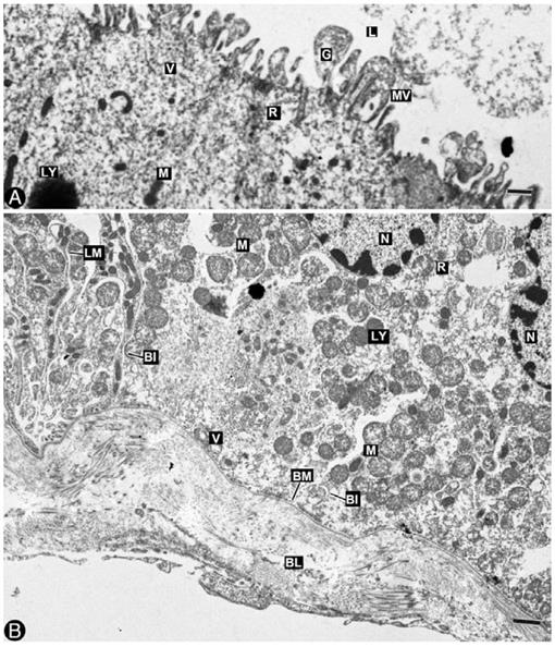 Ultrastructural Study of the Kidney in the Coelacanth Latimeria ...