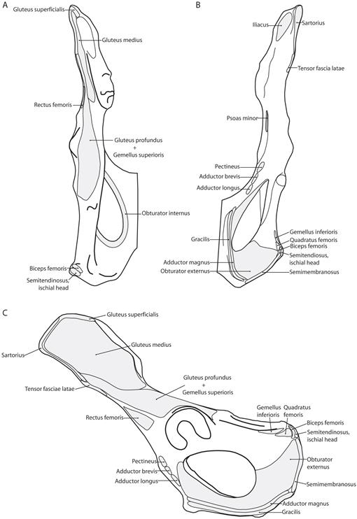 Psoas Zeichen und Obturatorzeichen