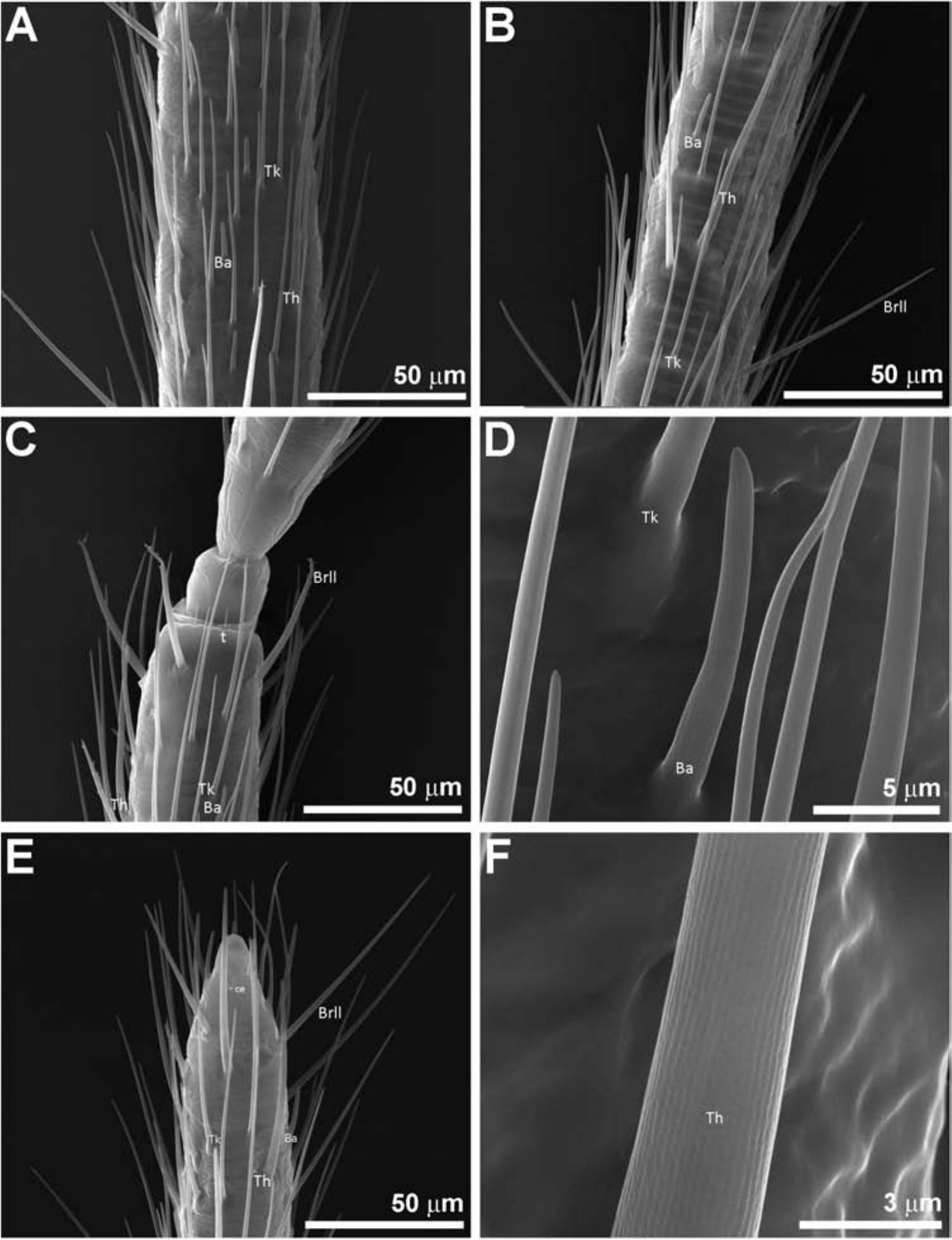 Comparative Study Of The Antennal Phenotype In Species Of The Belminus Hemiptera Triatominae Genus Using Optical And Scanning Electron Microscopy