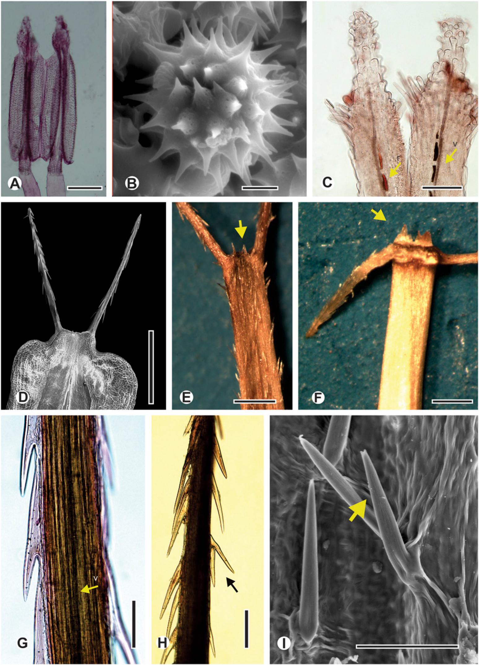 A Taxonomic Revision Of Heterosperma (Asteraceae: Coreopsideae)1