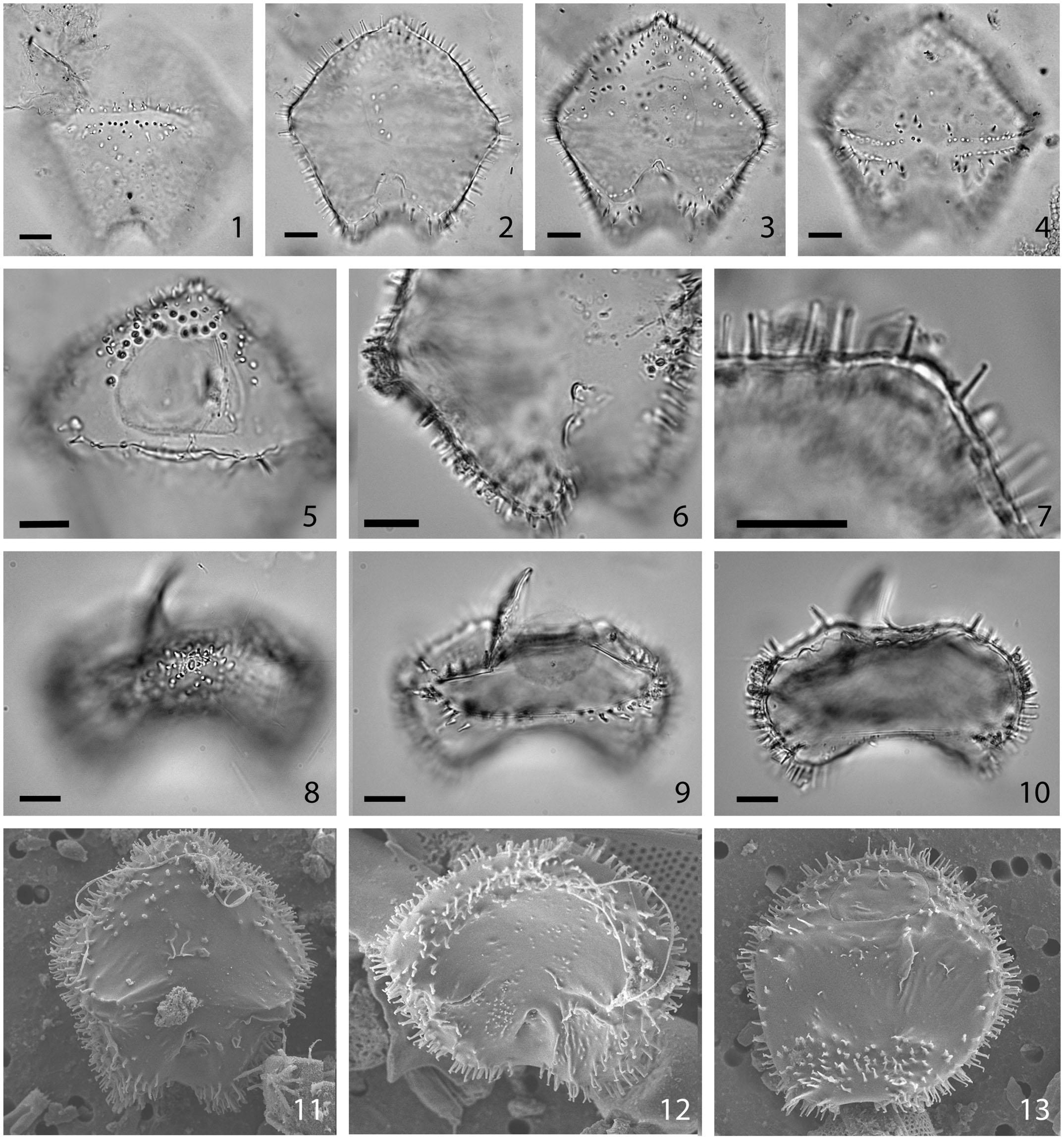 volume Mineraalwater hebben The cyst-theca relationship of the dinoflagellate cyst Trinovantedinium  pallidifulvum, with erection of Protoperidinium lousianensis sp. nov. and  their phylogenetic position within the Conica group