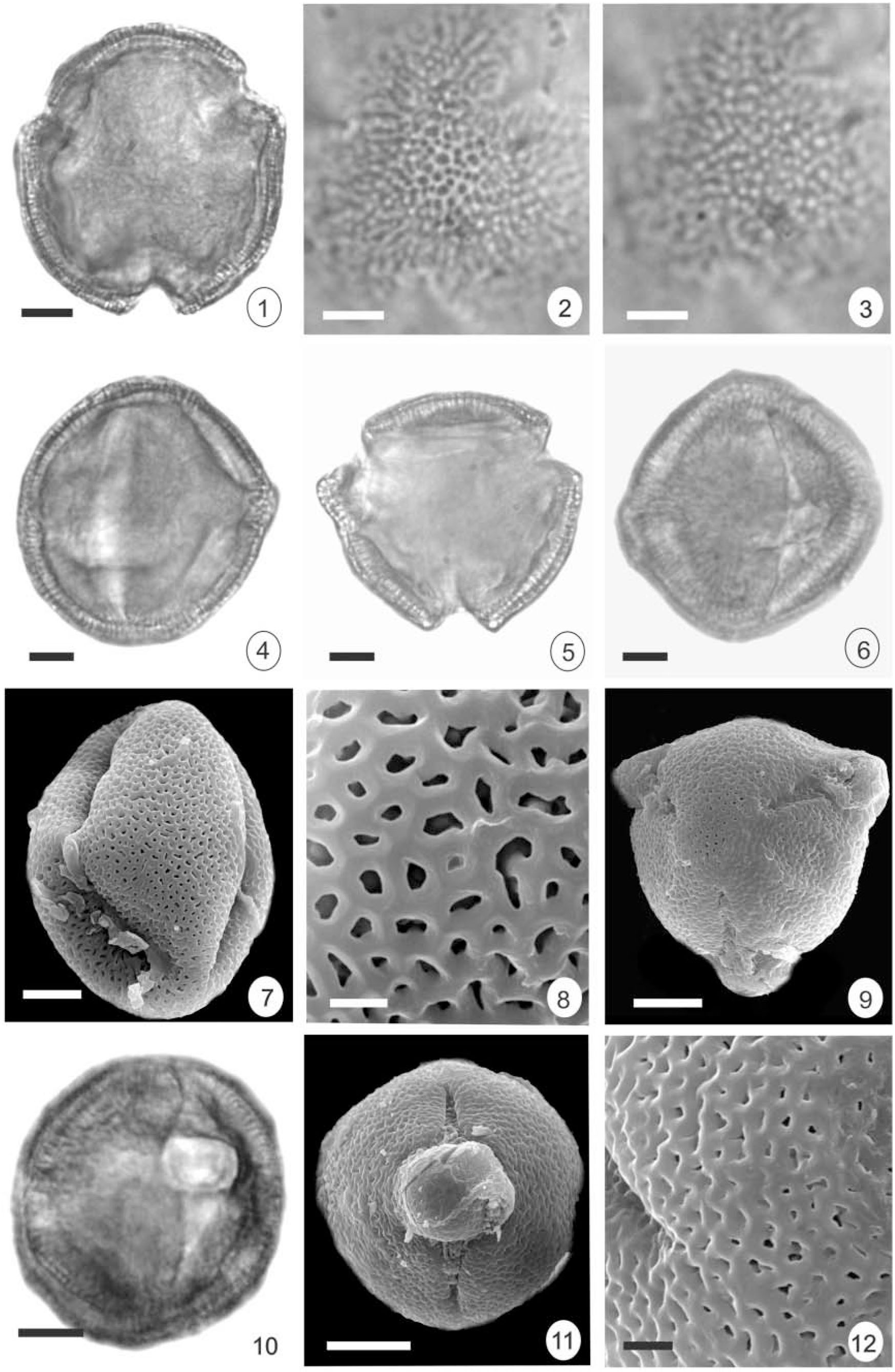 Pollen Morphology Of Selected Species Of Piriqueta Aubl 