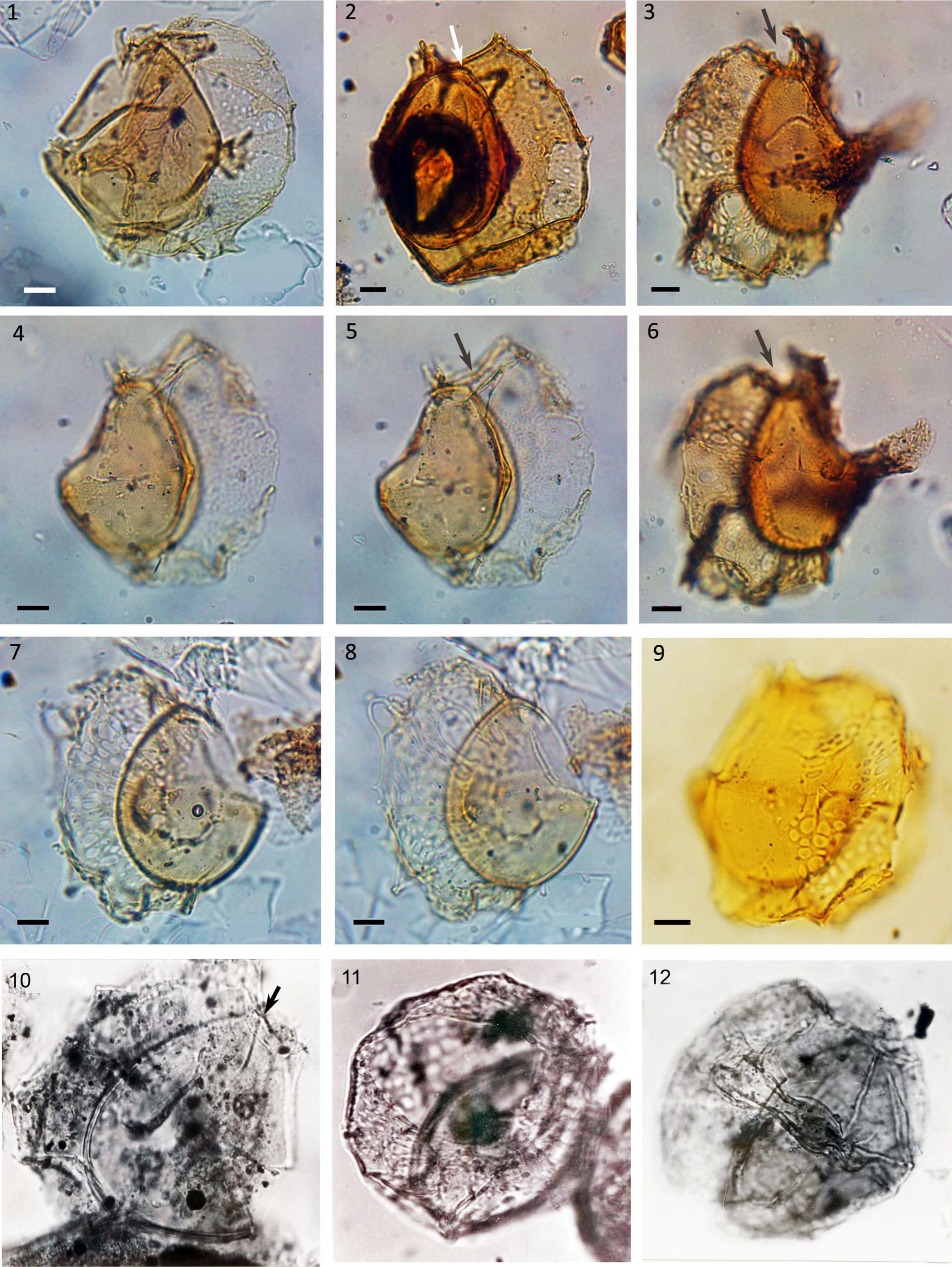 The Dinoflagellate Cysts Thalassiphora subreticulata n.sp. and ...