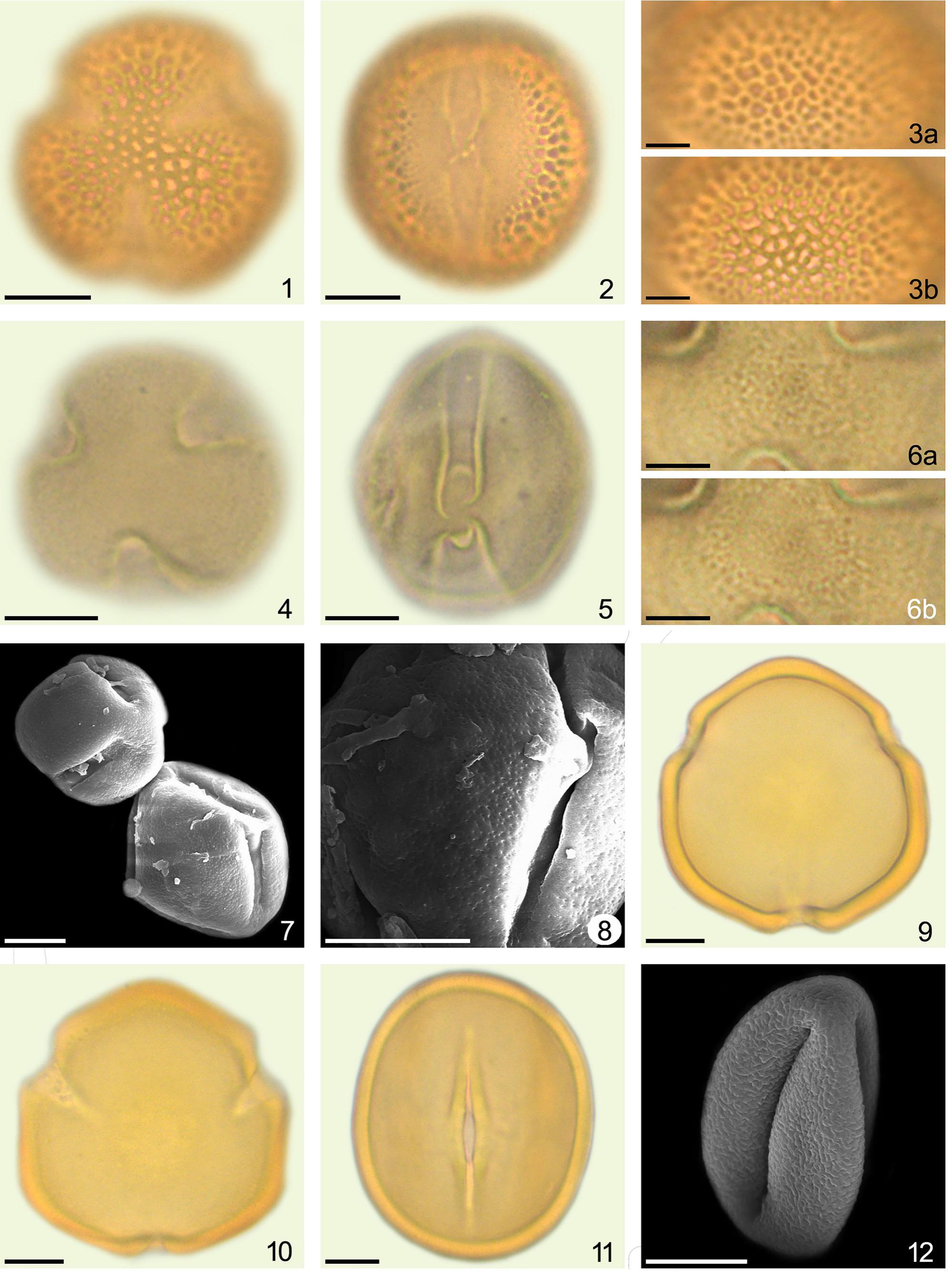 Additions to the Knowledge of the Pollen Morphology of Some Fabaceae ...