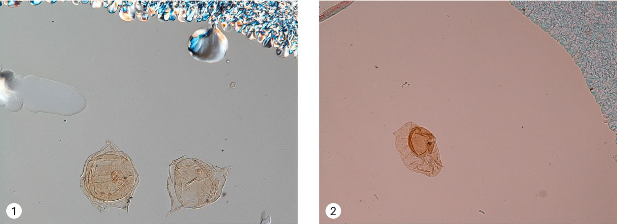 A Guide To Preparation Protocols In Palynology