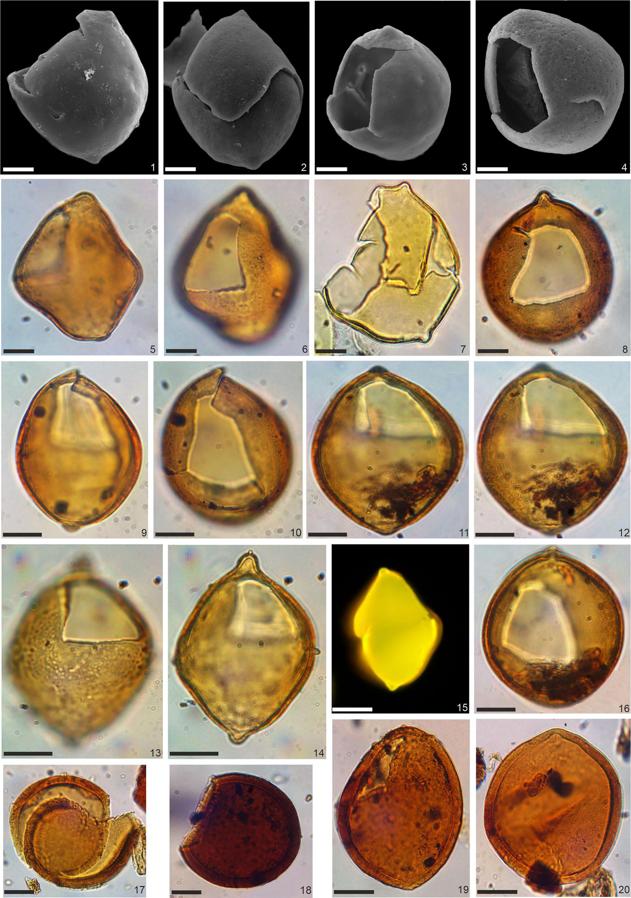 Revision of the Endemic Dinoflagellate Cyst Genus Pontiadinium Stover ...